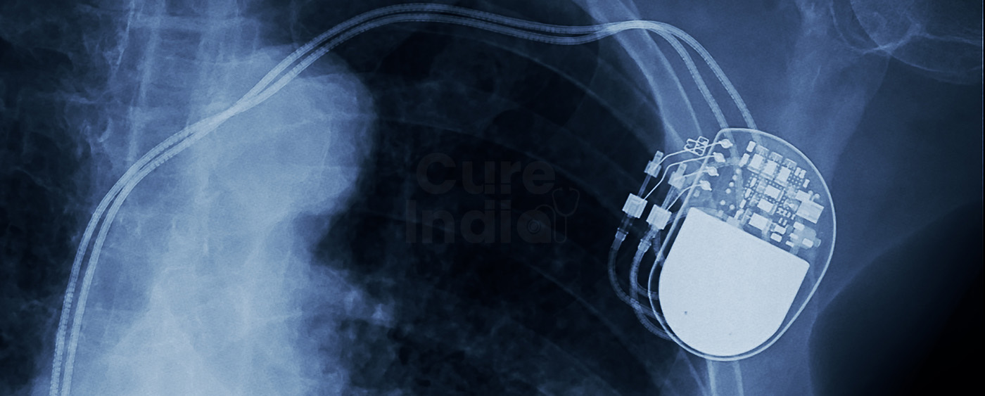 Pacemaker Insertion